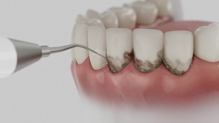Reliable Dental Implants contractor in Humboldt, KS by Smile Center Dentistry